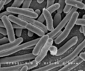 Ejemplo: Bacterias del cólera