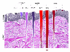 Light penetration in the skin