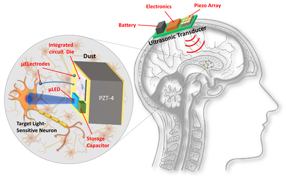 Micro Scale Implants Inside The Brain To Cure Parkinson S